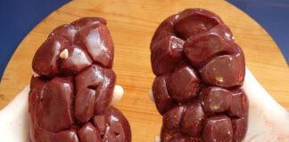 Czym się różni nerka od saszetki?